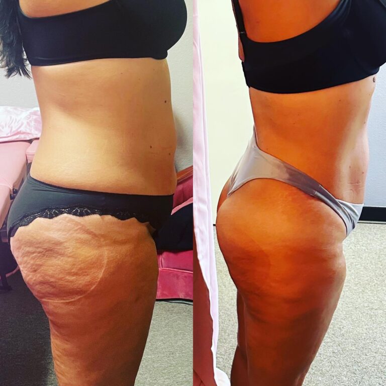 461E148A C066 43B5 87BA D01F801BFB83 768x768