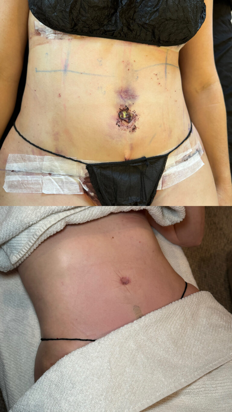 1C55DD3A 161B 4A61 BFAC 3B3A496C8340 768x1365