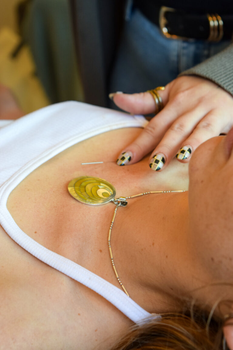 acupuncture 2025 33 768x1152