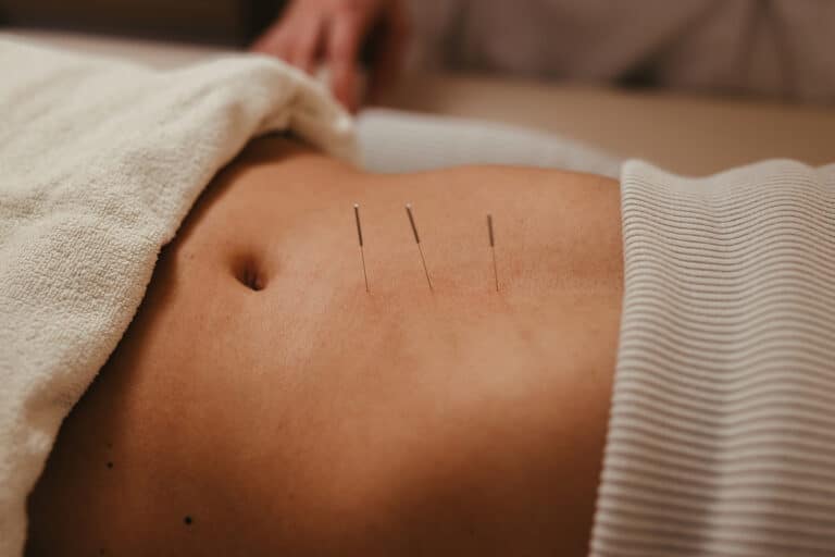 Woman receiving fertility acupuncture treatment at Seed Acupuncture Encinitas 768x512
